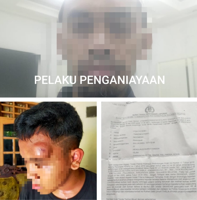 DIduga Kapolres Gowa Tutup Mata Adanya Kasus Penganiayaan Diwilayah Hukumnya  .
