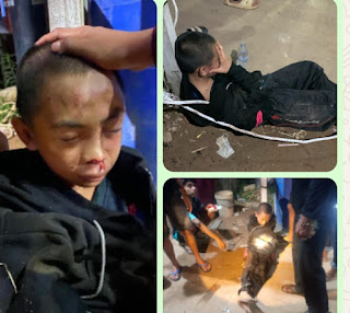 Kekerasan Anak Dibawah Umur Diketapang Aparat Proses Pelaku Penganiyaan .